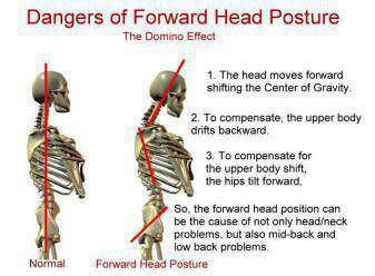 Consequences of incorrect head posture.
